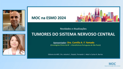 ESMO 2024: Tumores do Sistema Nervoso Central | Dra. Camilla Yamada