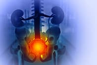 Durvalumabe recebe aprovação da ANVISA para o tratamento do câncer de bexiga ressecável