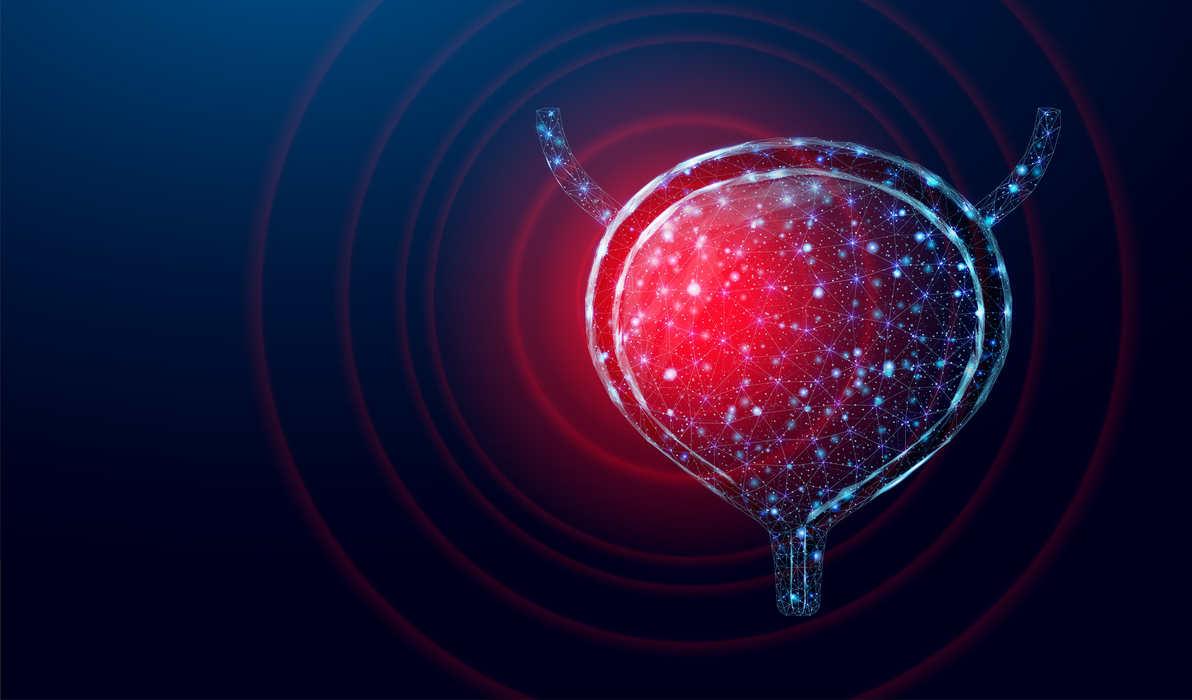 Dispositivo de gencitabina intravesical é aprovada pelo FDA para câncer de bexiga não-invasivo refratário a BCG