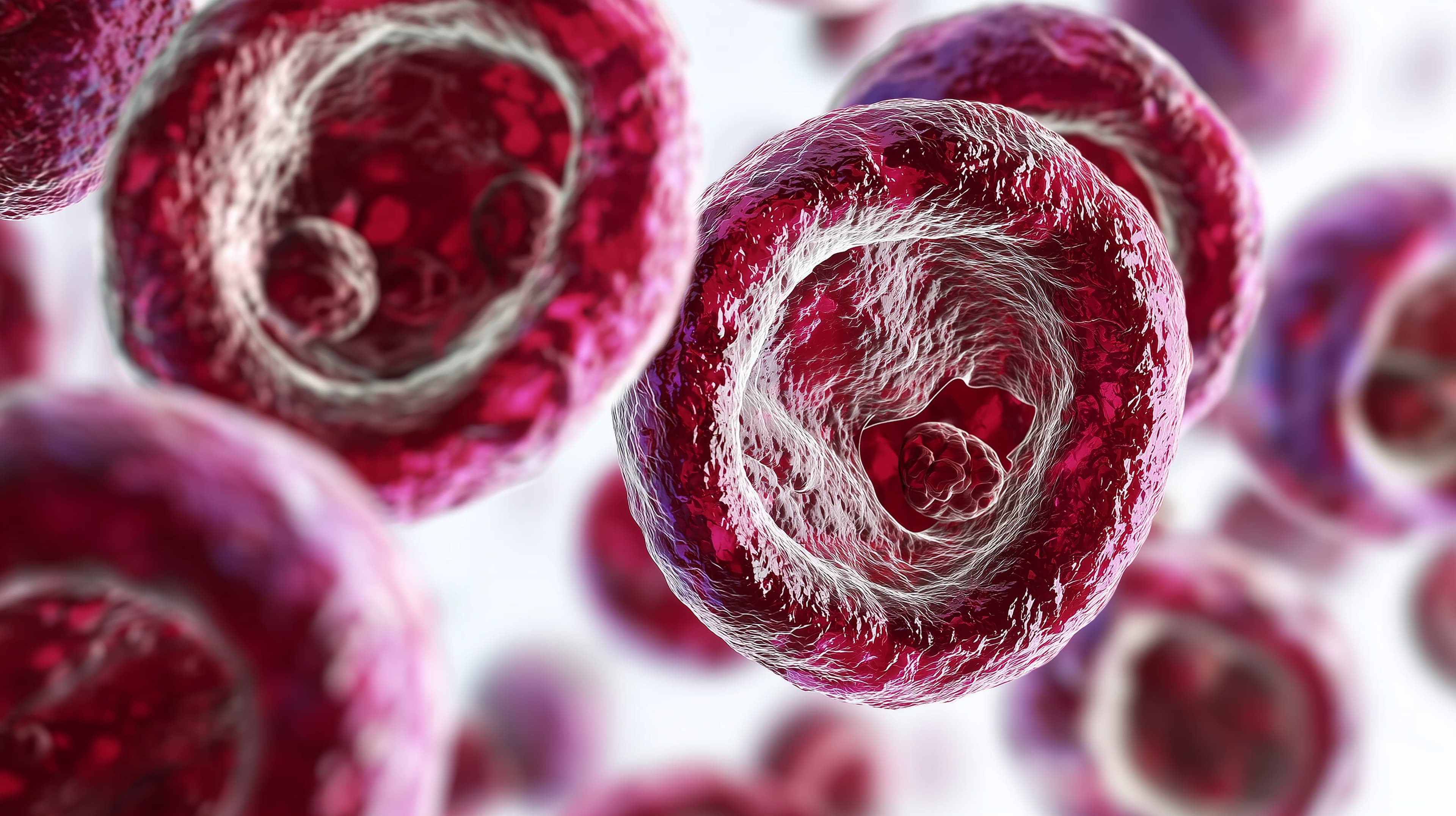 Inibidor de NPM1 aprovado para o tratamento da LMA nos EUA