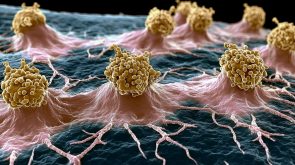 Image alternative text