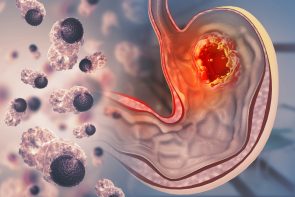 Image alternative text